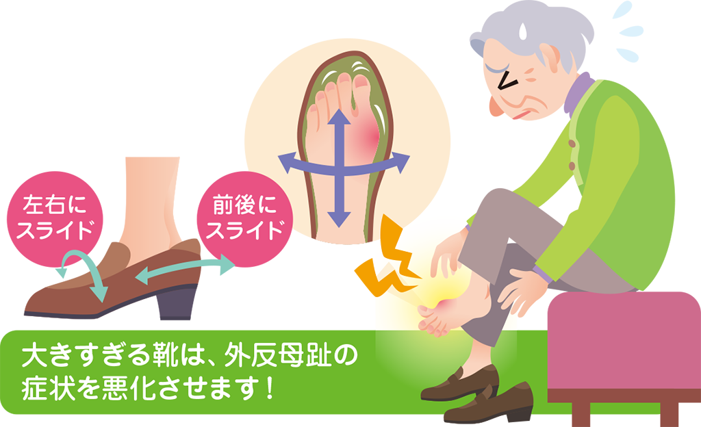 大きすぎる靴は、外反母趾の症状を悪化させます！